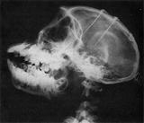 José Delgado - monkey brain implants