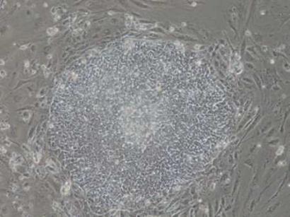 Undifferentiated stem cells (JPG)