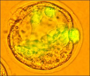 Human stem cells illuminated by green fluorescent proteins (JPG)